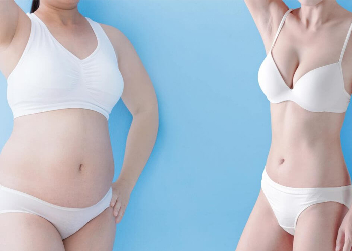 Giảm cân sau sinh – Mẹo làm giảm mỡ bụng hiệu quả