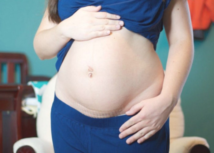 Top 4 loại thuốc giảm cân cho phụ nữ sau sinh bạn nên thử