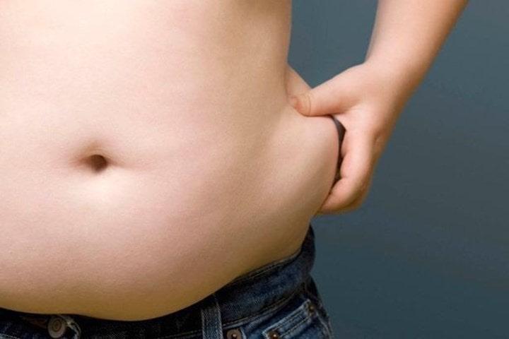 Di truyền cũng là nguyên nhân có thể dẫn tới việc bạn bị béo bụng.